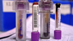 A picture taken on December 15, 2015 shows two blood samples of an athlete about to be analyzed at the French national anti-doping laboratory, in Chatenay-Malabry, outside Paris.  / AFP / FRANCK FIFE        (Photo credit should read FRANCK FIFE/AFP/Getty Images)