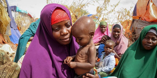 mother and malnourished child