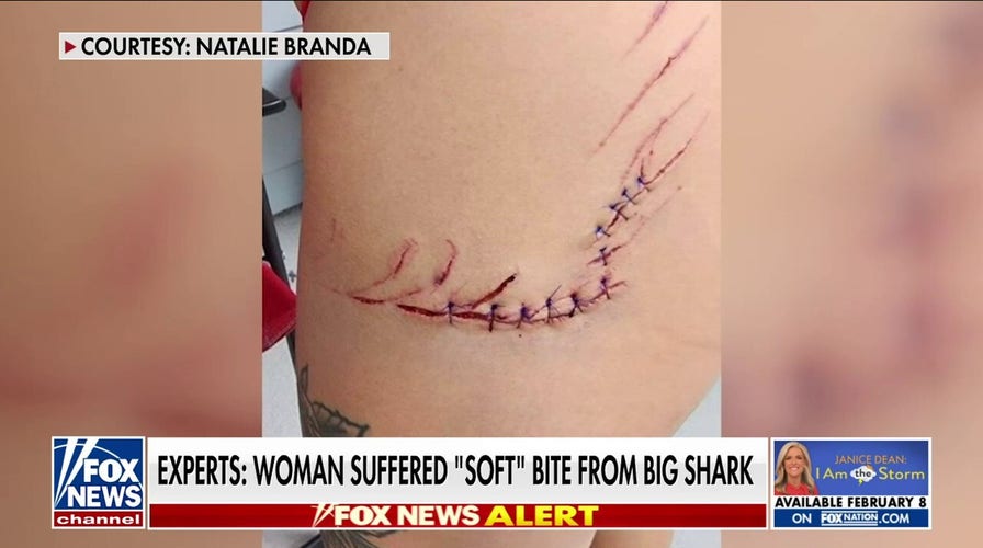 Florida woman survives shark attack, receives 14 stitches 