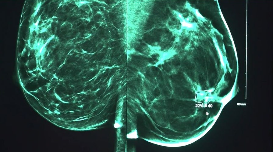AI detecting cancer in some US hospitals