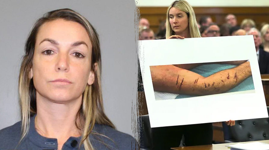 Is the 'dog bite' the key to everything in Karen Read's retrial?