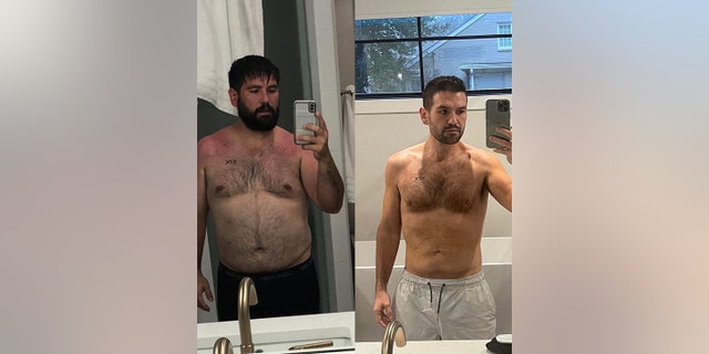 Shay Mooney shows off his 50-pound weight loss in a side-by-side photo he posted to Instagram where he is shirtless in both pictures