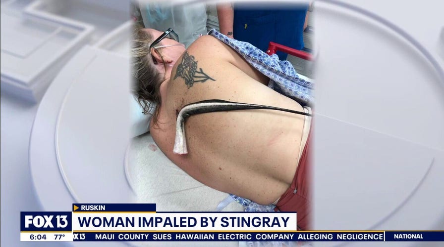 Florida woman impaled in back by stingray