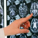 AI brain scan tool predicts how fast you are aging