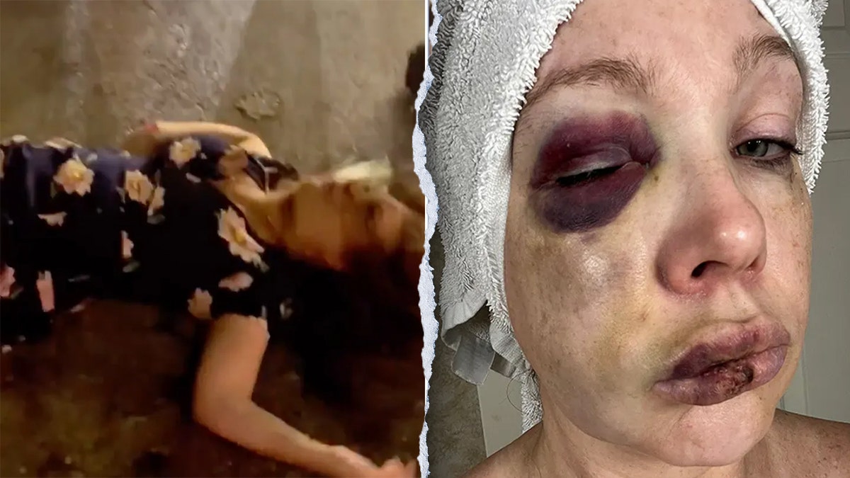 cincinnati-brawl-victim-holly