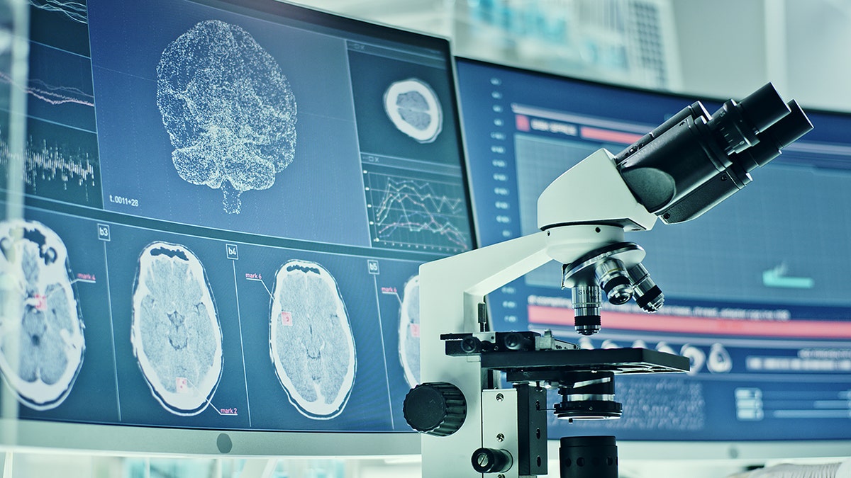 Microscope in front of screens with brain scans.