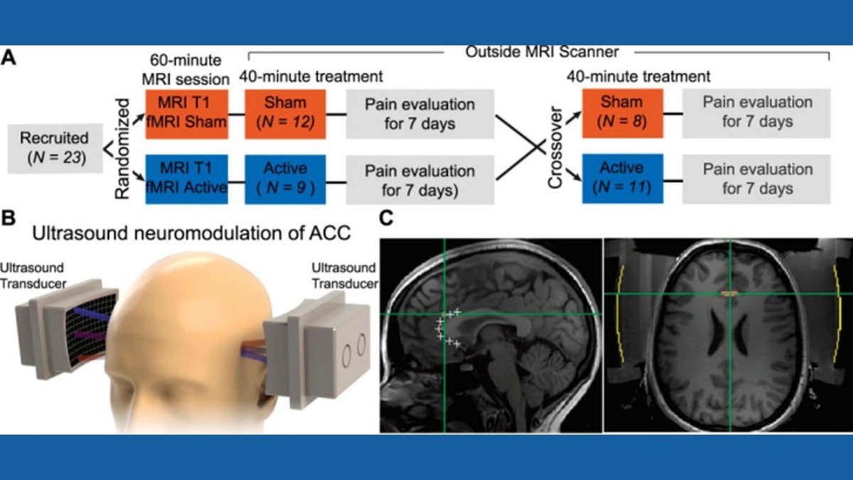 MRI guidance